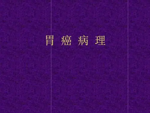 胃癌病理