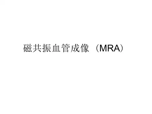 磁共振血管成像MRAppt课件