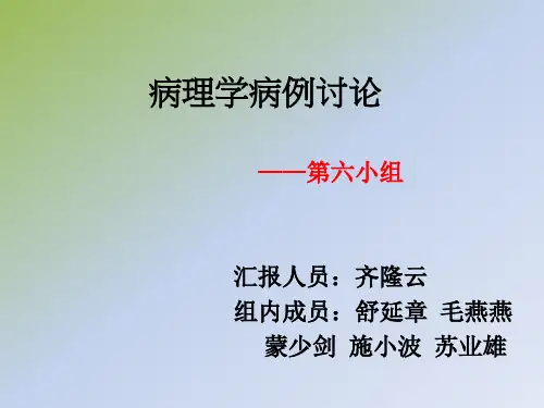 乳腺癌病例分析
