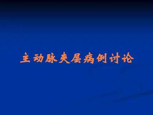 主动脉夹层病例讨论