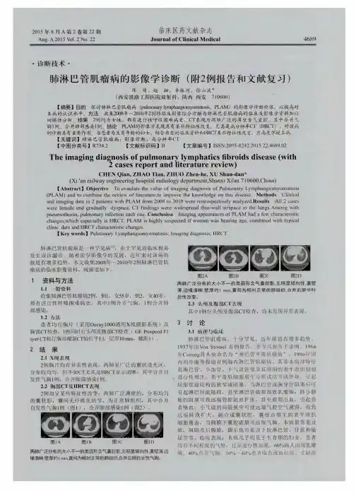 肺淋巴管肌瘤病的影像学诊断(附2例报告和文献复习)