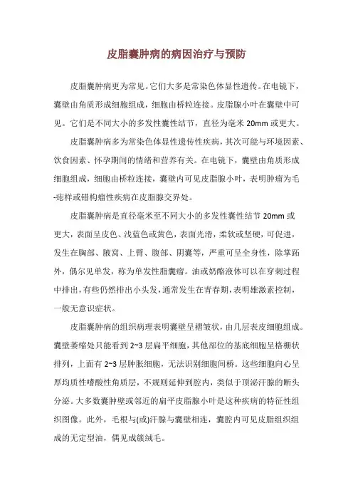 皮脂囊肿病的病因治疗与预防