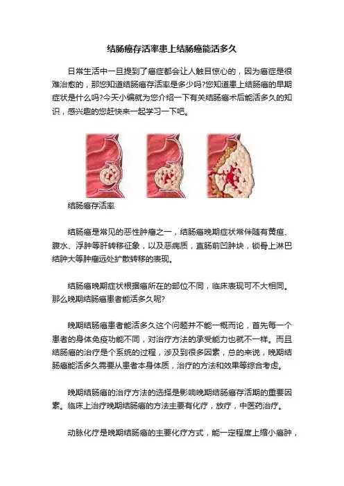 结肠癌存活率患上结肠癌能活多久