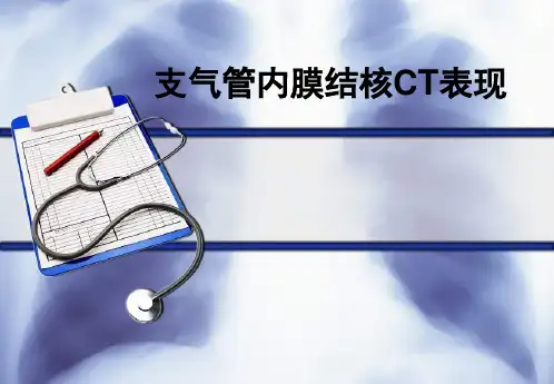 支气管结核PPT课件