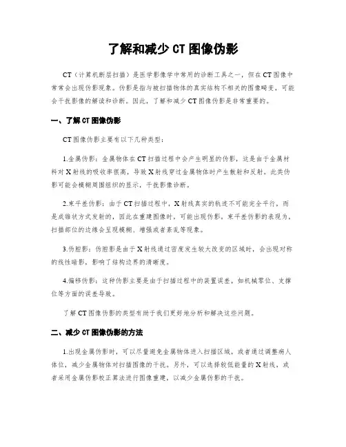 了解和减少CT图像伪影