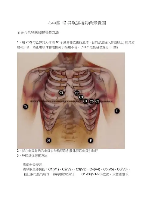 心电图12导联连接彩色示意图