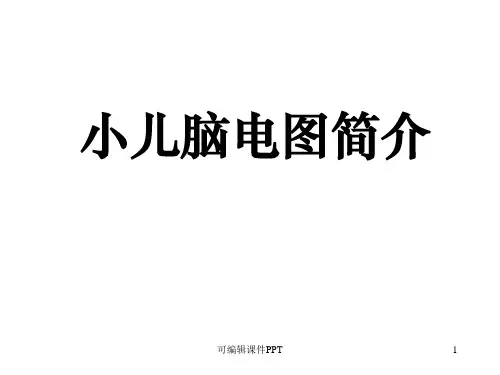 脑电图基础知识ppt课件