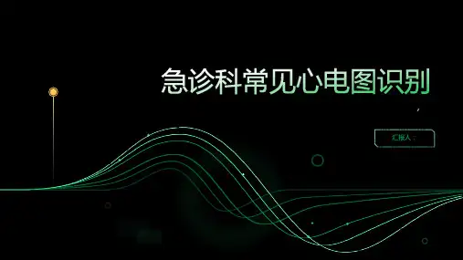 急诊科常见心电图识别