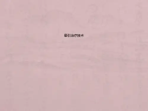 牵引治疗技术