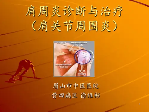 肩周炎诊断与治疗PPT课件