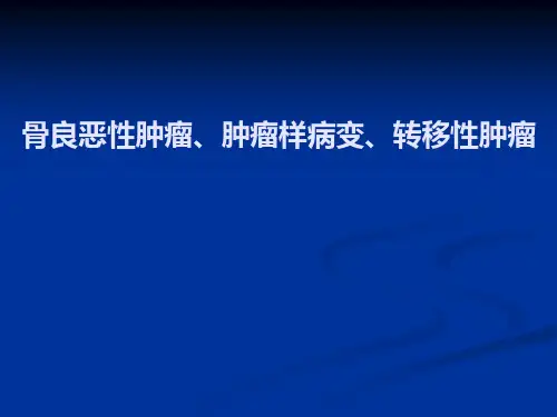 骨肿瘤影像诊断