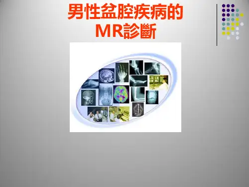 男性盆腔疾病MR表现  PPT课件