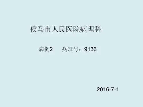 炎性肌纤维母细胞瘤PPT课件