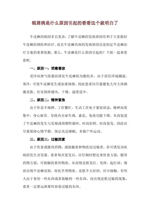 银屑病是什么原因引起的 看看这个就明白了