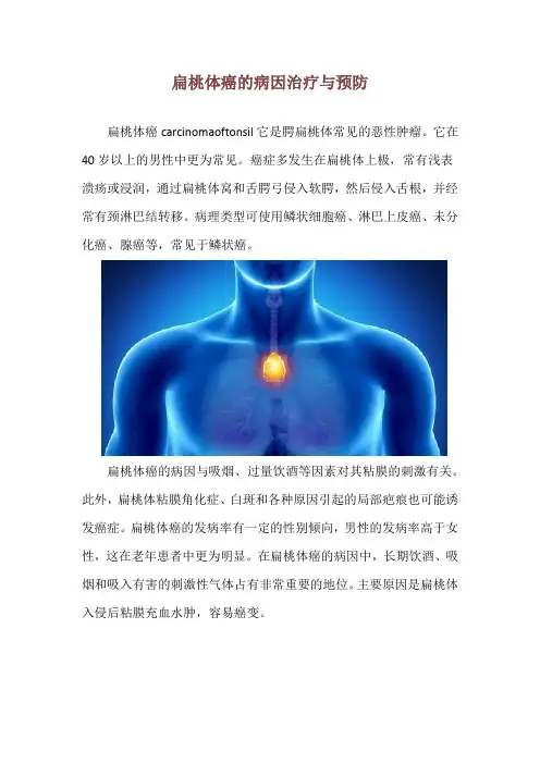 扁桃体癌的病因治疗与预防