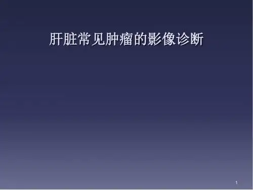 肝脏肿瘤的影像诊断医学PPT课件