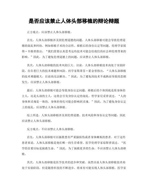 是否应该禁止人体头部移植的辩论辩题