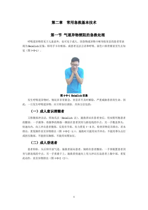 常用急救基本技术