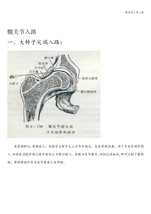 髋关节三种入路