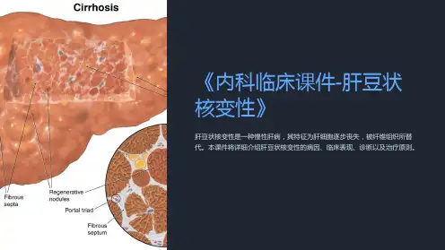 《内科临床课件-肝豆状核变性》
