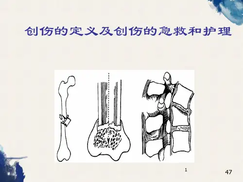 创伤的定义及创伤的急救和护理