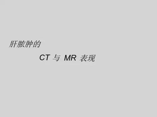 肝脓肿的CT、MR表现