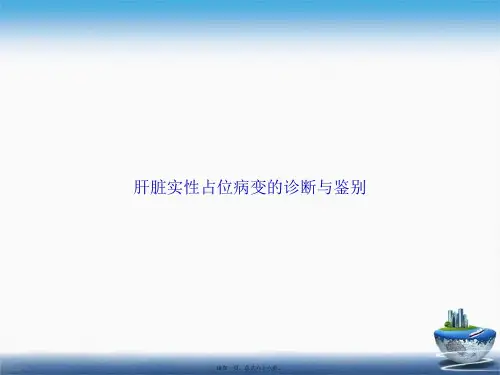 肝脏实性占位病变的诊断与鉴别讲课文档