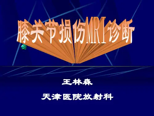 膝关节损伤MRI诊断