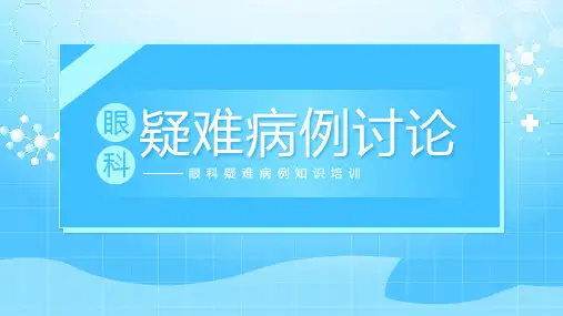 眼科疑难病例讨论眼科疑难病例知识培训