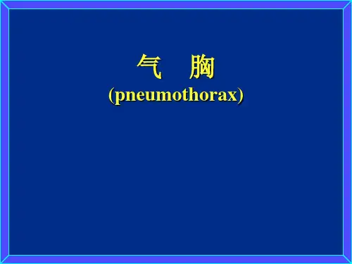 气胸2