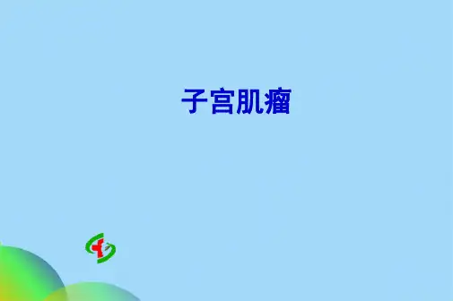 子宫肌瘤课件PPTppt(共21张PPT)
