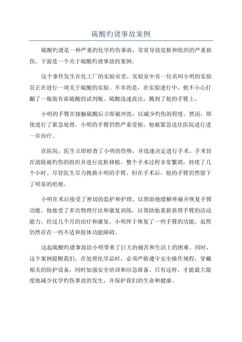 硫酸灼烫事故案例