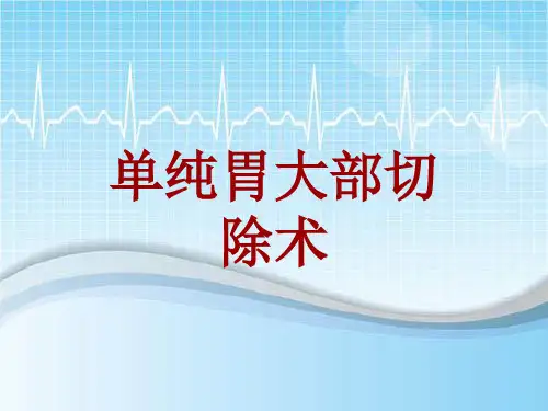 手术讲解模板：单纯胃大部切除术