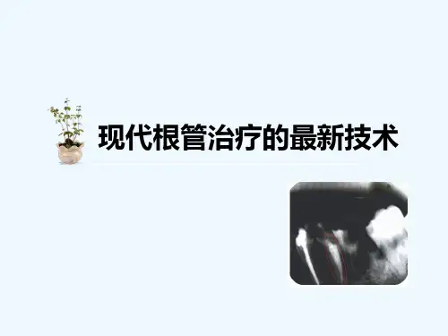 根管治疗技术