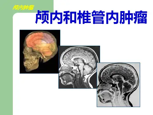 颅内肿瘤及颅内椎管肿瘤血管性疾病