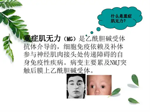 重症肌无力PPT课件