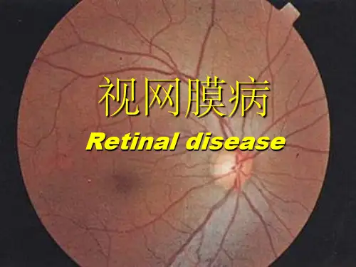 视网膜病图谱