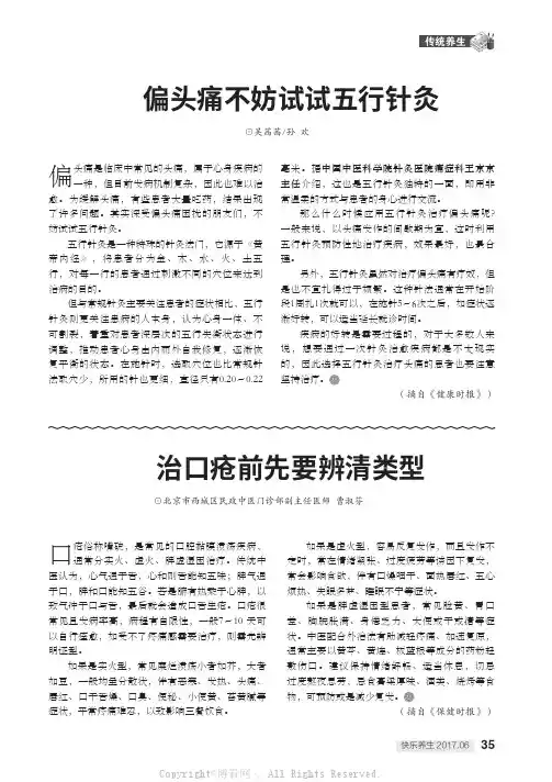 偏头痛不妨试试五行针灸