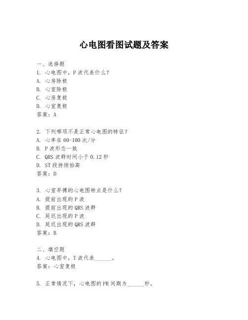 心电图看图试题及答案