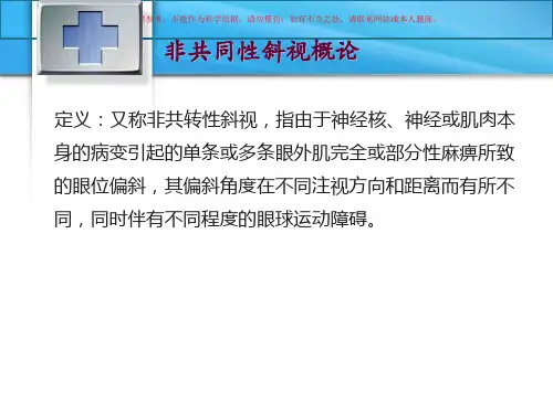 非共同性斜视课件