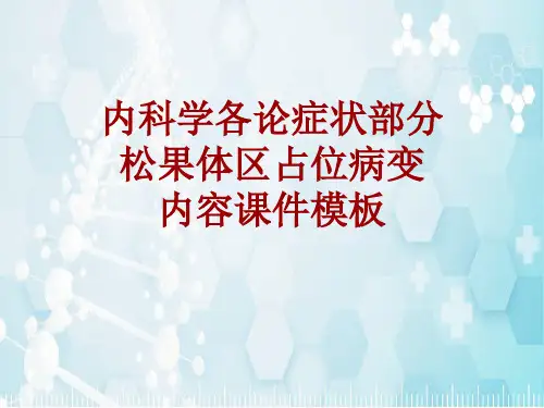 内科学_各论_症状：松果体区占位病变_课件模板