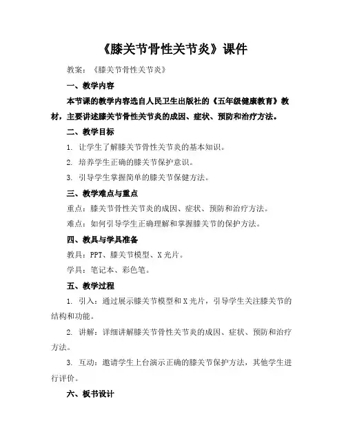 《膝关节骨性关节炎》课件