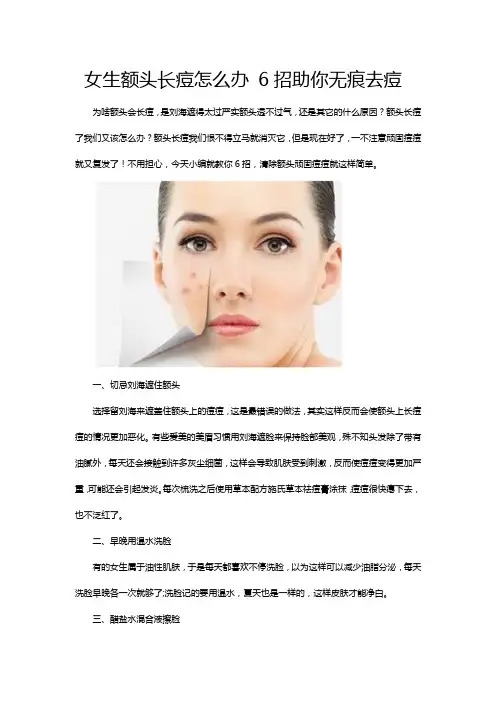 女生额头长痘怎么办 6招助你无痕去痘