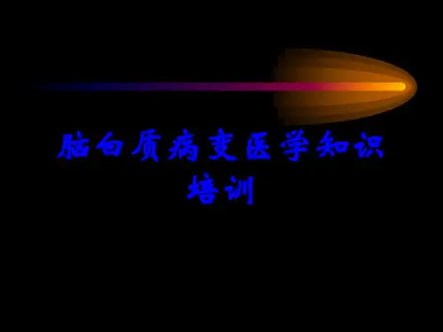 脑白质病变医学知识培训