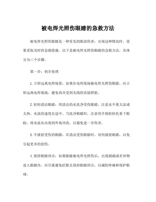 被电焊光照伤眼睛的急救方法