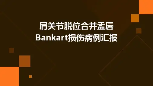 肩关节脱位合并盂唇Bankart损伤病例汇报