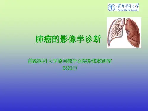 肺癌的影像学检查ppt课件