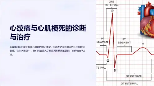 心绞痛与心肌梗死的诊断与治疗