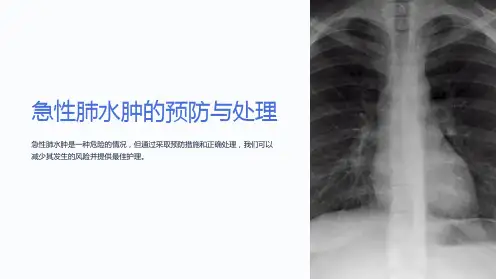 急性肺水肿的预防与处理