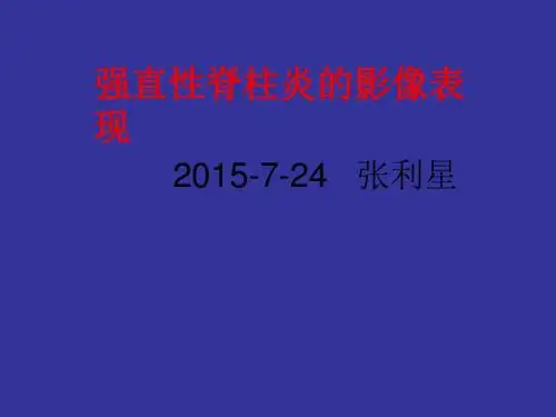 15.7.24强直性脊柱炎的影像表现 张利星